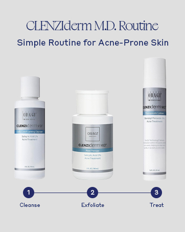 Help Control Acne